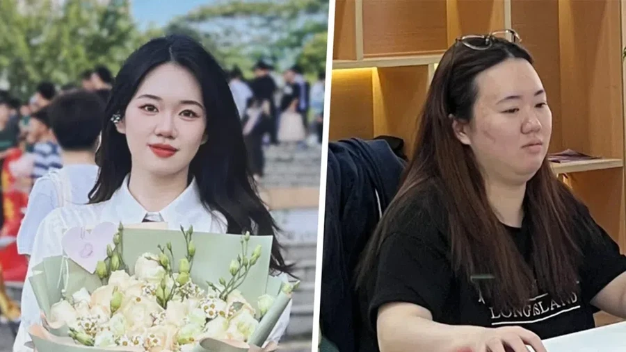 Ouyang Wenjing, karyawati naik BB 20 kg dalam setahun.