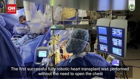 VIDEO: RS Arab Saudi Sukses Operasi Transplantasi Jantung Pakai Robot