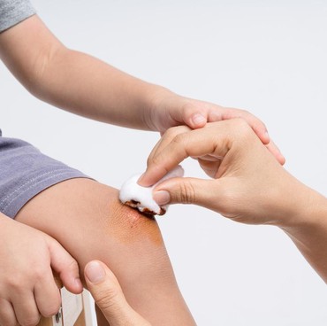 Mengenal Metode 4C, Cara Tangani Luka Anak dengan Tepat Tanpa Drama