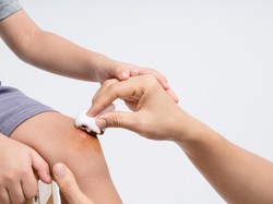 Mengenal Metode 4C, Cara Tangani Luka Anak dengan Tepat Tanpa Drama