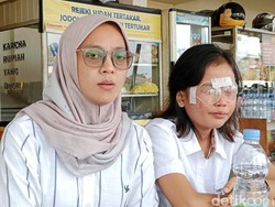 Berlian Korban Malapraktik Bidan di Palembang Butuh Bantuan Cangkok Kornea