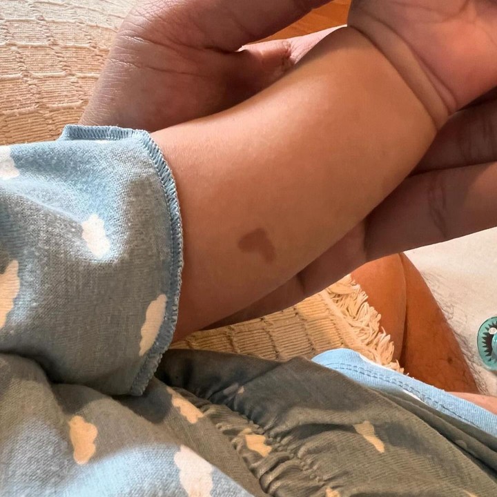 <p>Elio terlihat memiliki tanda lahir berbentuk hati. “Hah itu <em>birthmarknya loveshaped?”</em> tulis akun @sher.sut**. “Tanda lahirnya gemes banget,” tulis akun @melza**. “Tanda lahirnya masa hati nakk,” tulis akun @anka**. (Foto: Instagram@jojosuherman)</p>