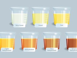 10 Warna Urine dan Artinya, Yuk Kenali Kondisi Kesehatan Tubuhmu!