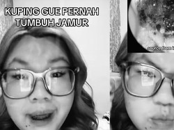 Viral Wanita Tangsel Punya Jamur di Kuping, Dokter Bicara Sederet Pemicunya