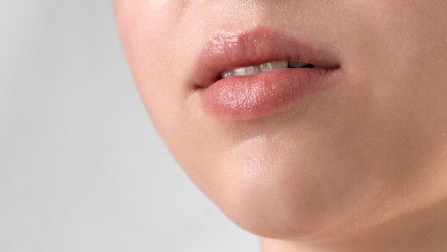 Kenapa Bibir Sering Kering? Ini 4 Penyebab Utamanya!