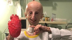 img-title Sosok Sammy Basso Penyintas Genetik Langka Progeria yang Meninggal Dunia