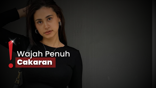 Selebgram Afifah Riyad Unggah Wajah Babak Belur di-KDRT Suami
