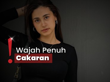 Selebgram Afifah Riyad Unggah Wajah Babak Belur di-KDRT Suami