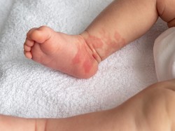Ojol di Medan Terima Paket, Ternyata Isinya Mayat Bayi Hasil Hubungan Inses