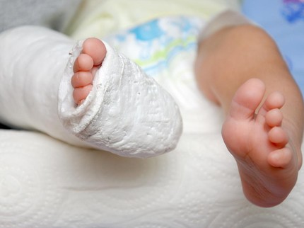 Kisah Bayi Alami Kondisi Tulang Rapuh Sejak Lahir, Bisa Patah 70 Kali dalam Setahun