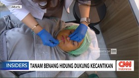 VIDEO: Tanam Benang Hidung Dukung Kecantikan