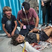 Pilunya Kondisi Terkini di Gaza Utara: Hanya 1 Dokter Tersisa dan Tidak Ada Air-Makanan