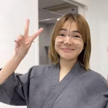 Bikin Pangling, Penampilan Terbaru Maya Septha Usai Oplas di Korea