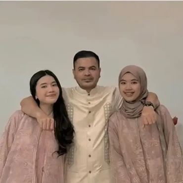 Profil Anak Sambung Irish Bella, Ada yang Calon Dokter