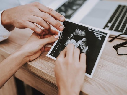 Kenali Penyebab Twin to Twin Transfusion Syndrome (TTTS), Komplikasi Kehamilan Janin Kembar