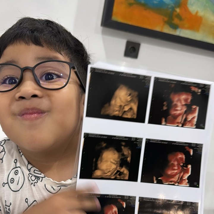 <p>Jelang persalinan, Risa mengunggah foto hasil USG anak keduanya. Dalam foto yang dibagikan, tampak sang putra Ari memegang hasil USG adiknya yang wajahnya sudah terlihat jelas. Risa sendiri belum mengumumkan jenis kelamin anak keduanya ini ke publik. (Foto: Instagram @risa_saraswati)</p>