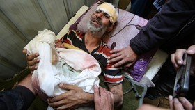 FOTO: Tumpukan Mayat-Ratapan Warga Gaza Imbas Serangan Brutal Israel