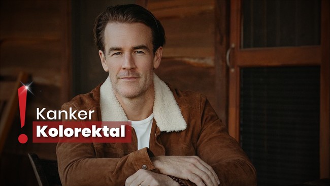 Pemain Serial 'Dawson' Creek', James Van Der Beek Didiagnosis Kanker