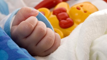 Kelainan piebaldisme pada anak