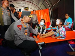 Kapolri Jenguk Anak Korban Erupsi Lewotobi di Posko Kesehatan Pengungsian