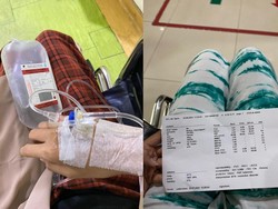Awal Mula Wanita Jaktim Kena Pneumonia, Sempat Dikira Cuma Masuk Angin Biasa