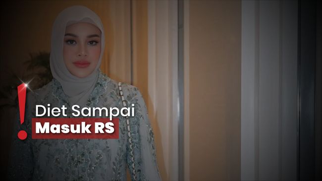 BB Turun hingga 21 Kg, Aurel Hermansyah Bersyukur Tak Di-bully Lagi