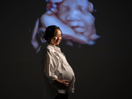 5 Potret Uniknya Maternity Shoot Gritte Agatha, Foto USG Jadi Background Bun