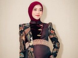 Lesti Kejora Dipolisikan Terkait Hak Cipta