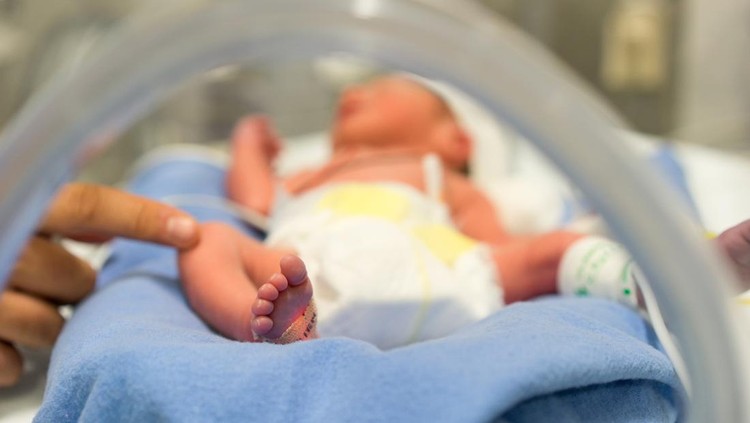 Perawatan bayi kuning