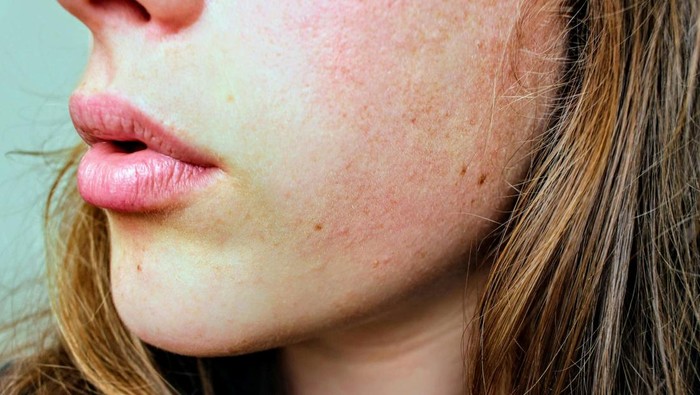 img-title Bye-bye Kulit Kering! Ini 4 Rahasia Jitu untuk Dapatkan Kulit Lembap Halus Nan Cantik
