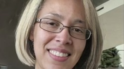 Pamer Wajah Tanpa Make Up, Wajah Asli Doja Cat Bikin Pangling