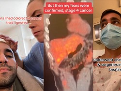 Viral Pria Mengeluh Sakit Perut, Tak Tahunya Kena Kanker Kolorektal Stadium 4