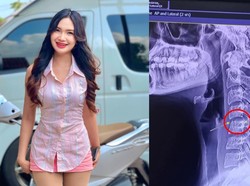 Tragis Akhir Hidup Penyanyi Muda Thailand gegara Pijat