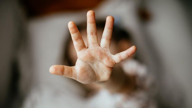 Dokter Kandungan di Garut Diduga Lecehkan Pasien, Minta Tak Boleh Ditemani Suami