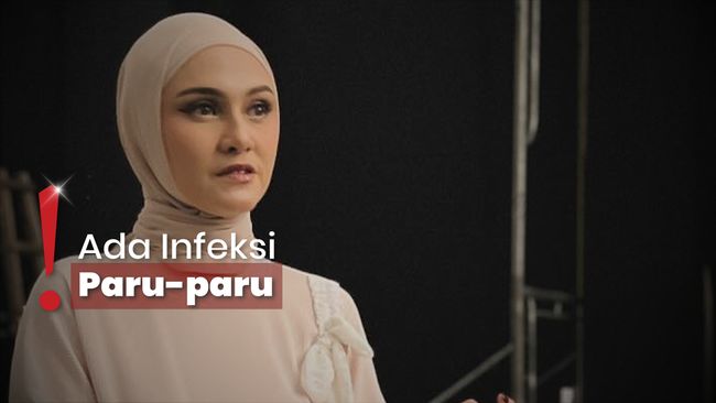 Ibu Zee Zee Shahab Meninggal, Prabu Revolusi: Mama Sulit Bernapas