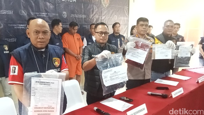Polisi menunjukkan barang bukti dalam kasus penganiayaan mahasiswa koas Palembang.