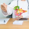 Ini 6 Makanan yang Ampuh Hancurkan Batu Empedu