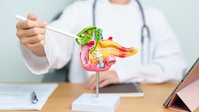 Konsumsi 6 Makanan Ini agar Tidak Terkena Batu Empedu