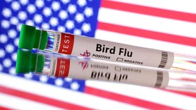 AS Laporkan Kasus Flu Burung Parah Pertama pada Manusia