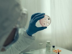 4 Fakta HKU5-CoV-2, Virus Baru yang Mirip COVID-Bisa Menginfeksi Manusia