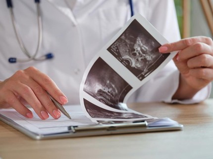 Mengenal Fase Blastula dalam Perkembangan Embrio Bunda