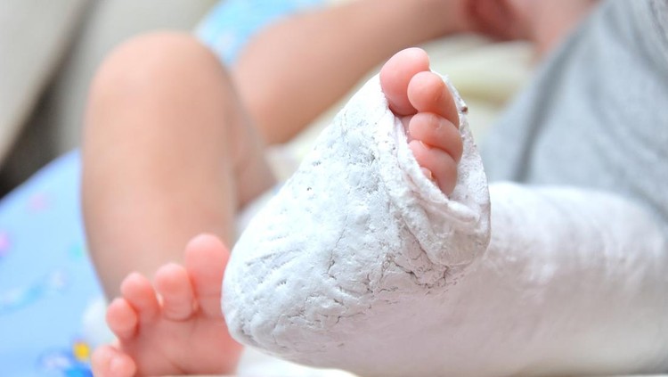 Ilustrasi kaki anak patah terjepit di eskalator mal Ilustrasi kaki anak patah terjepit di eskalator mal
