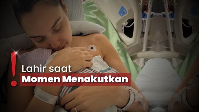 Gal Gadot Alami Penggumpalan Darah di Otak saat Hamil Anak Keempat