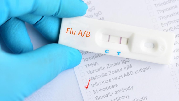 Ilustrasi influenza A Influenza A/B positive test result by using rapid test cassette