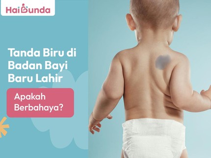 Tanda Biru di Badan Bayi Baru Lahir, Apakah Berbahaya?