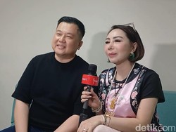 Femmy Permatasari Cerita soal Operasi Plastik yang Biayanya Capai Rp 700 Juta