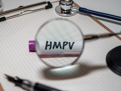HMPV Sudah Masuk Indonesia, Pakar UGM Sebut Tak Sebabkan Penyakit Fatal