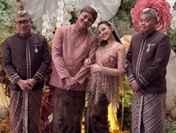 Perubahan Besar Rizky Febian dan Wejangan Sule