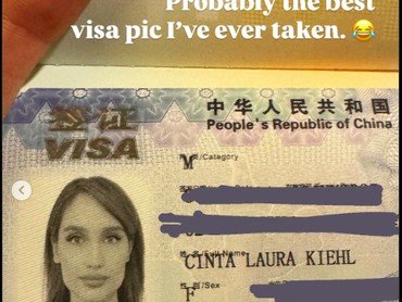 Wajah Mulus dan Memesona, Foto Visa Cinta Laura Jadi Sorotan