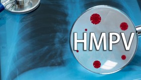 Simak Ya, Ini Cara Cegah Anak Tertular Virus HMPV di Sekolah